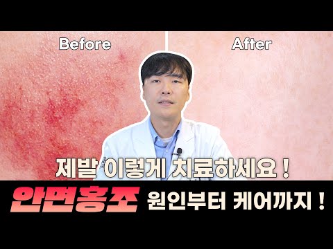 ?안면홍조? 이 영상 하나로 완전 정복 ✨ I 중요한 건 피부 장벽 강화 시켜주기?! (feat.EGF)