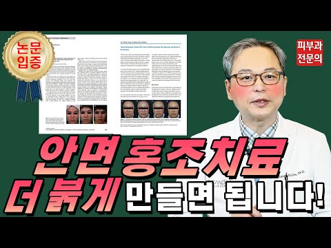 세계적 학회에 소개한 ? 안면홍조 없애는법 ? 공개 (Feat. 홍반유도프리마)