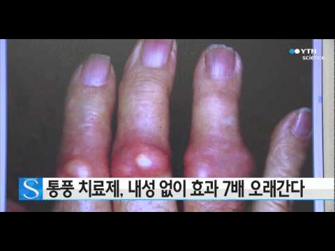 통풍 치료제, 부작용 없이 효과 7배 늘린다 / YTN 사이언스