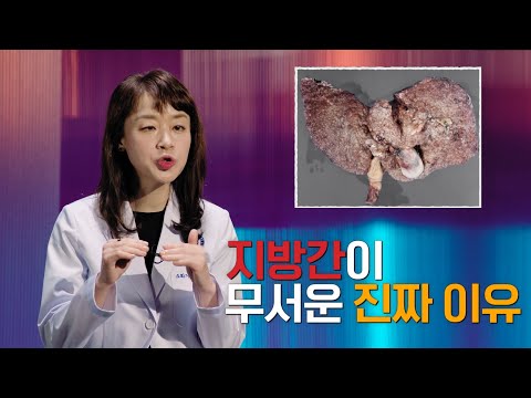 '지방간이 무서운 진짜 이유 | 지방간 | 지방간염 | 간경화 | 간암 | 명의 | #EBS건강