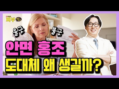 얼굴이 울긋불긋 빨개지는 안면 홍조 ‘이것’때문에 생긴다?! – 박치영의 피부 톡톡 #42 안면홍조