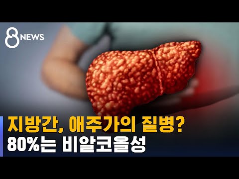 [건강라이프] 지방간, 애주가의 질병?…80%는 비알코올성 / SBS