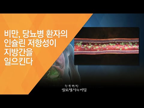 비만, 당뇨병 환자의 인슐린 저항성이 지방간을 일으킨다 - (2015.11.25_563회 방송)_내 몸의 시한폭탄! 지방간(肝)의 경고