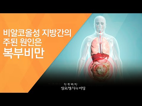 비알코올성 지방간의 주된 원인은 복부비만 - (2016.3.30_577회 방송)_습관변화 프로젝트 2편, 일어서야 내 몸이 산다