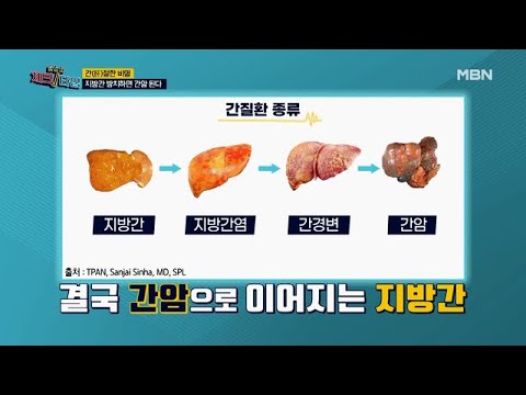 간(肝)절한 비명! 지방간 방치하면 간암 된다! MBN 201221 방송