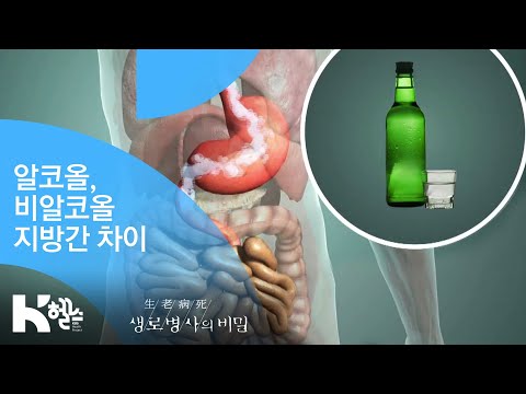 알코올,비알코올 지방간 차이 - (20181003_664회 방송) 지방간의 습격, 방치하면 돌이킬 수 없다