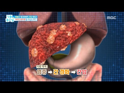 [Happyday]Fatty liver cause? 지방간의 원인은 무엇일까? [기분 좋은 날] 20170224