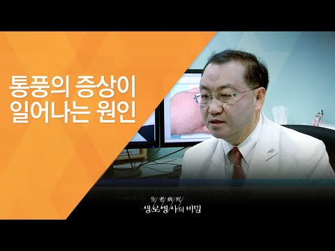 통풍의 증상이 일어나는 원인 - (20150204_534회 방송)_통풍의 습격, 합병증