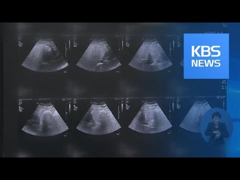 ‘지방간은 간 문제?’…당뇨 발생 위험 80%↑ / KBS뉴스(News)