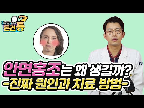 안면홍조는 왜 생기는걸까? 그 원인과 치료 방법을 알려드립니다!