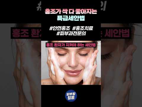 안면홍조, 세안만 잘해도 싹 다 좋아집니다 #홍조 #안면홍조 #안면홍조없애는법