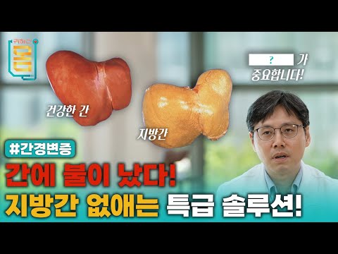 [Full] 간에 불이 났다! 지방간 없애는 특급 솔루션! #간경변증ㅣ귀하신 몸ㅣ79화 간이 굳기 전에, 지방간 다이어트