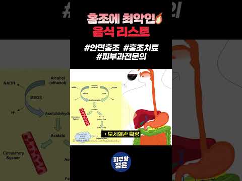 안면홍조에는 이런 "음식" 무조건 피하세요 #홍조 #안면홍조 #홍조없애는법